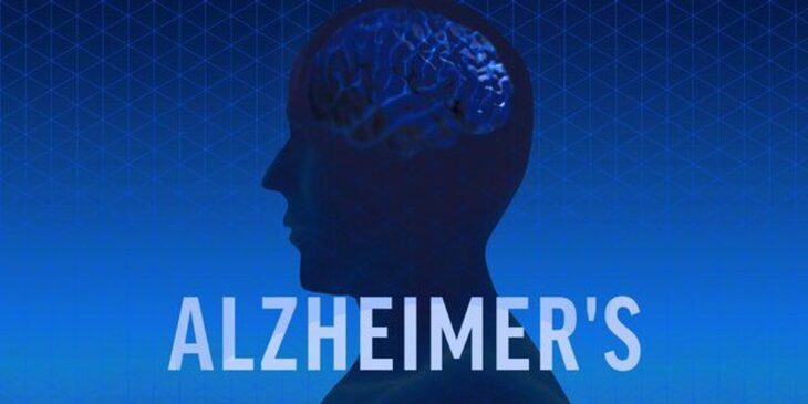 Raising Awareness of Alzheimer’s